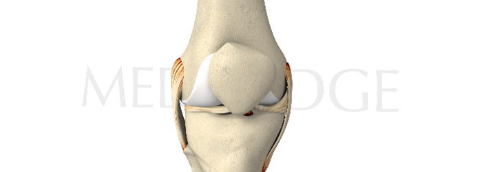 Articular Cartilage Defects: The Neglected Factor in ACL Injuries and Return to Sport